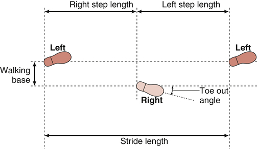 B9780323056694100148_f14-02-9780323056694